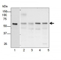 KARI | Ketol-acid reductoisomerase              